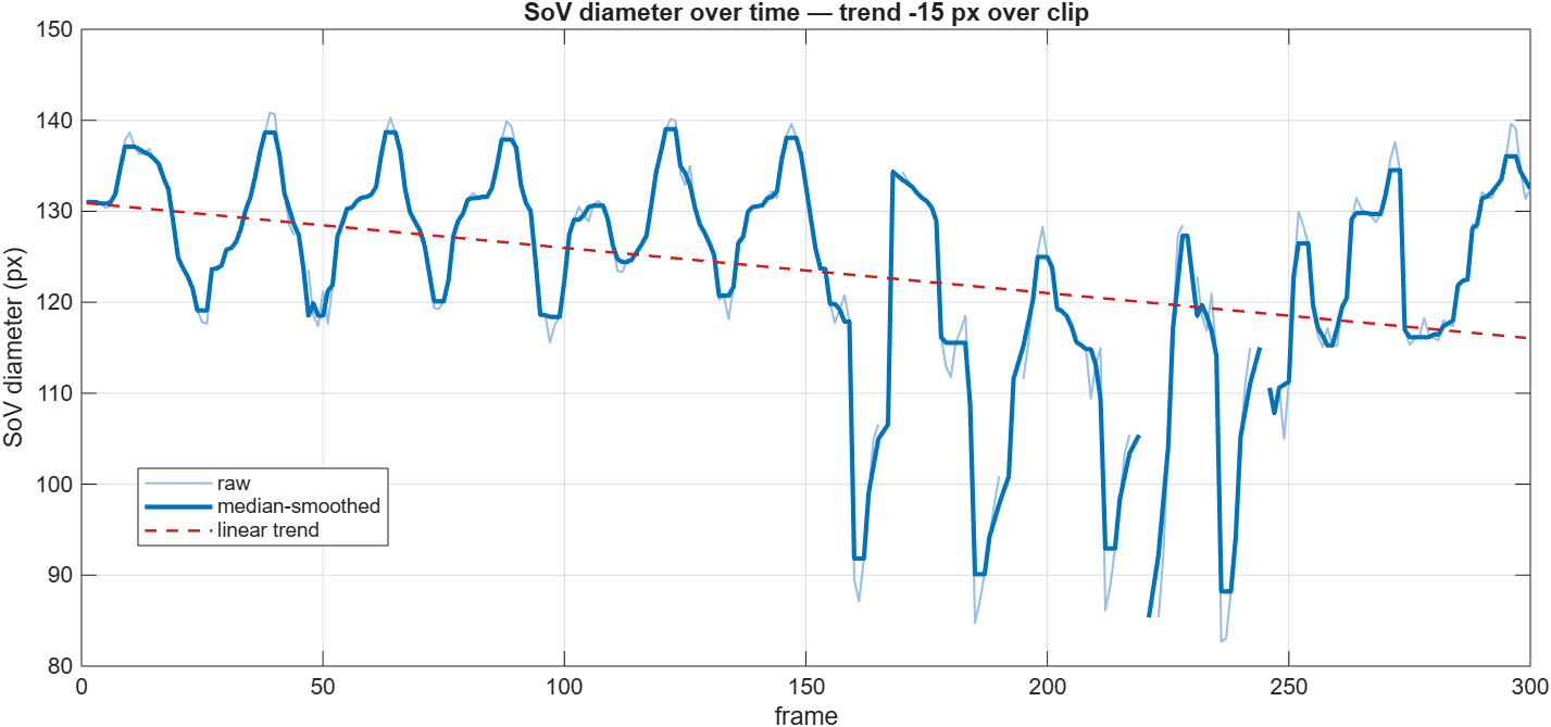 SoV diameter over time from the per-frame detector