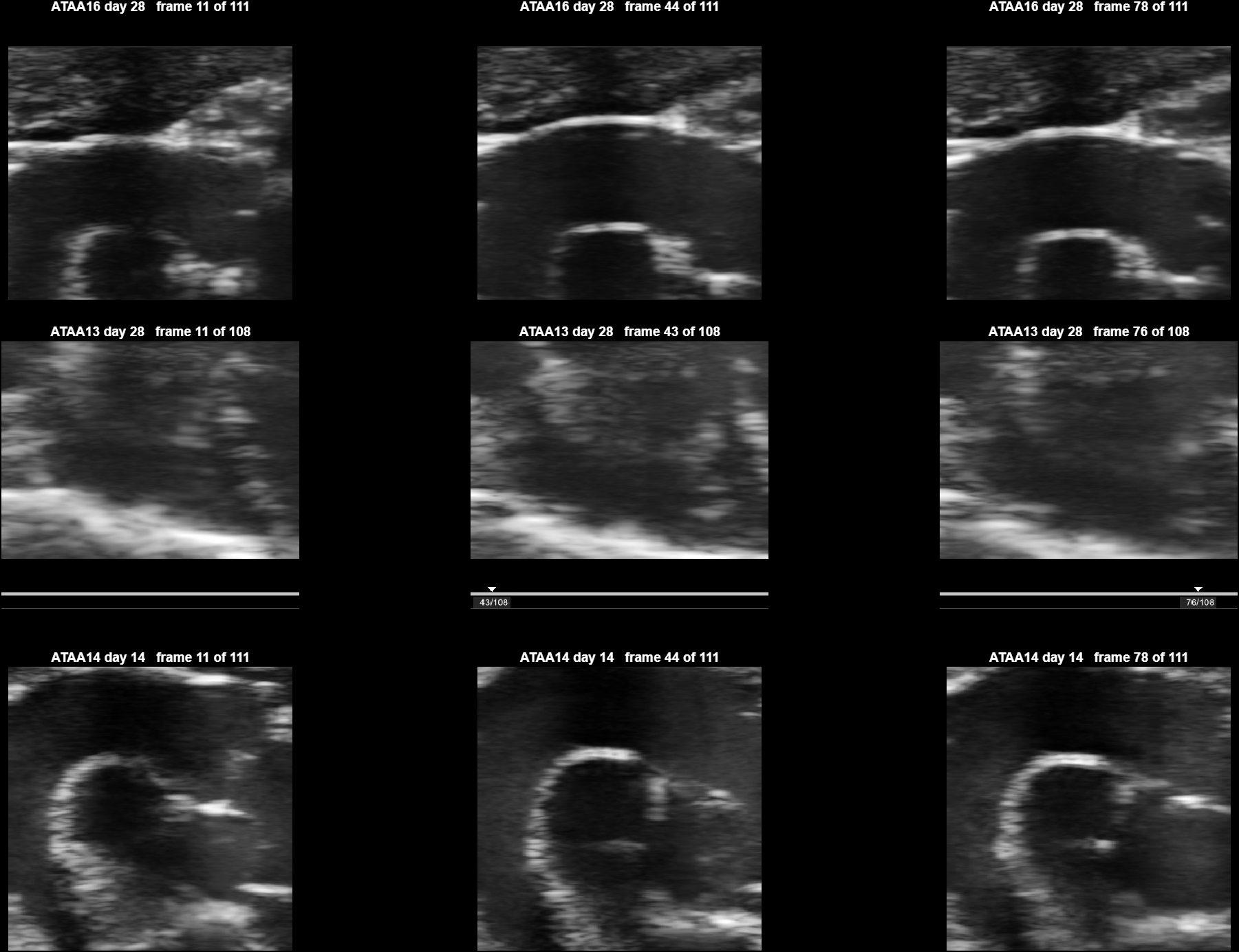 Three EKV clips zoomed to the vessel at three phases each