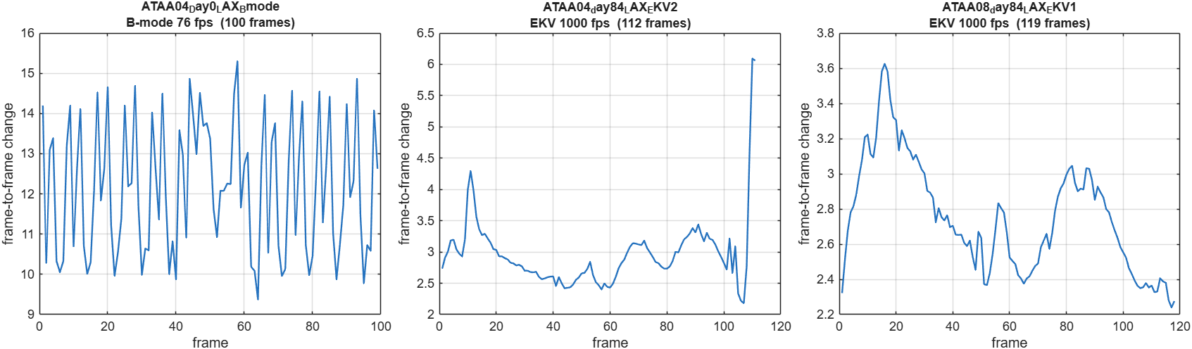 Frame-to-frame image change for one B-mode and two EKV clips