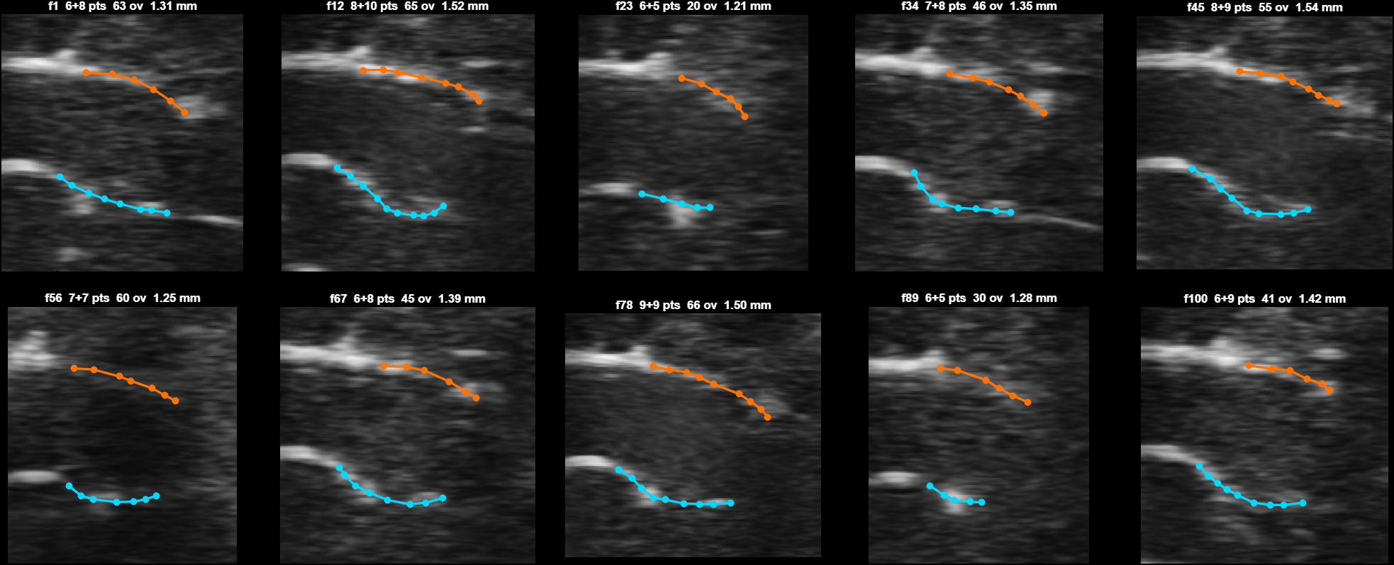 Ten hand tracings on the second validated animal