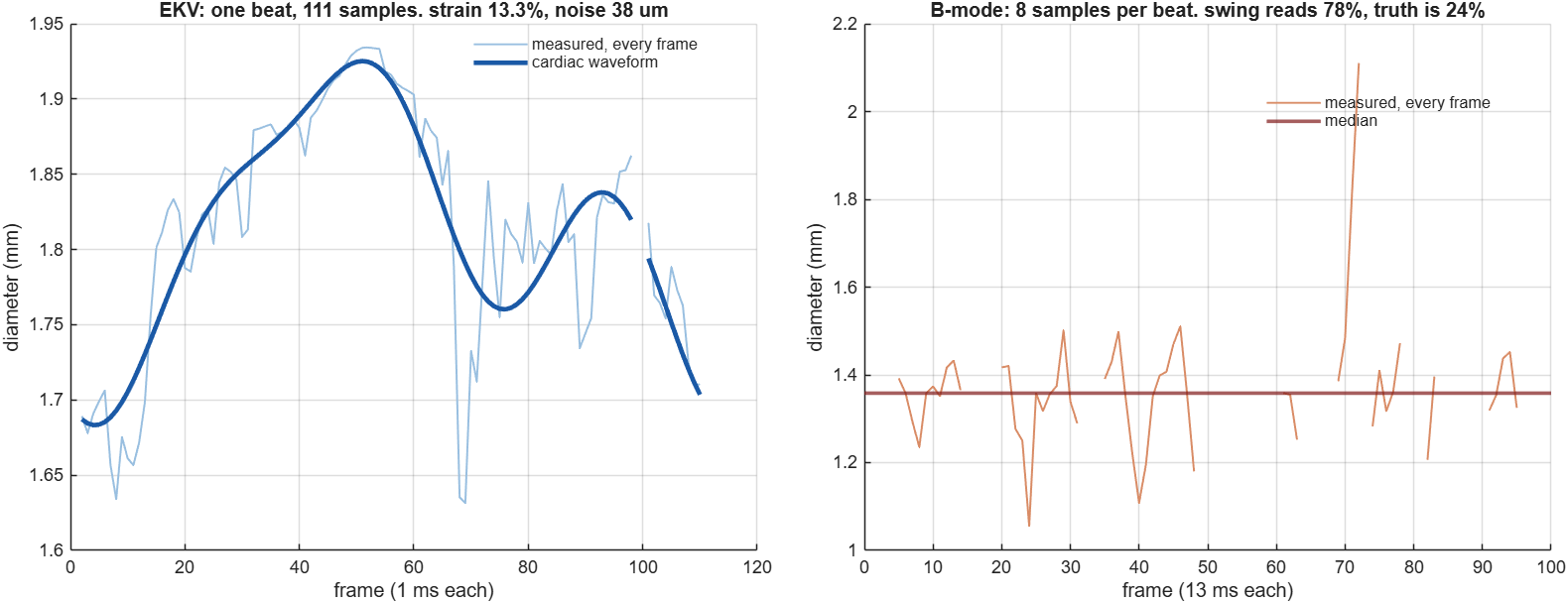 Diameter over one beat, EKV against B-mode